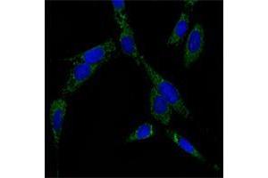 Immunofluorescence analysis of NIH/3T3 cells using HSP70 mouse mAb (green). (HSP70 antibody)