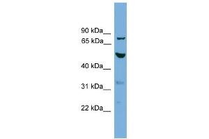 WB Suggested Anti-TUBA8 Antibody Titration: 0. (TUBA8 antibody  (N-Term))
