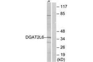 Western blot analysis of extracts from Jurkat cells, using DGAT2L6 Antibody. (DGAT2L6 antibody  (AA 271-320))