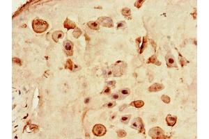 Immunohistochemistry of paraffin-embedded human placenta tissue using ABIN7167815 at dilution of 1:100 (Retinoid X Receptor gamma antibody  (AA 13-133))