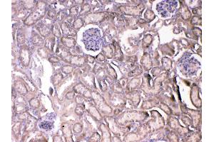 IHC analysis of VEGF Receptor 2 using anti-VEGF Receptor 2 antibody . (VEGFR2/CD309 antibody  (AA 20-244))