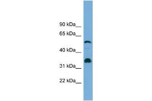 WB Suggested Anti-CYP26B1 Antibody Titration: 0. (CYP26B1 antibody  (Middle Region))
