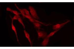 Immunofluorescence (fixed cells) (IF/ICC) image for anti-Tumor Protein P53 (TP53) (pSer15) antibody (ABIN6256151)