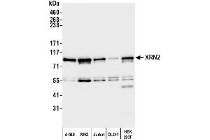 Western Blotting (WB) image for anti-5'-3' Exoribonuclease 2 (XRN2) (AA 900-950) antibody (ABIN7454718)