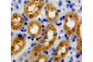 Used in DAB staining on fromalin fixed paraffin-embedded kidney tissue (PPM1A antibody  (AA 2-382))