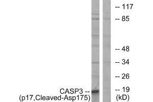 Western blot analysis of extracts from COLO cells, using CASP3 (p17, Cleaved-Asp175) antibody. (Caspase 3 antibody  (Cleaved-Asp175))