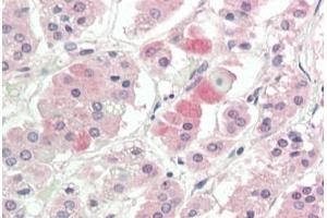 SLC1A4 antibody  (C-Term)