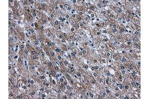 Image no. 1 for anti-V-Akt Murine Thymoma Viral Oncogene Homolog 2 (AKT2) antibody (ABIN1496564) (AKT2 antibody)