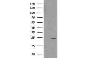 Western Blotting (WB) image for anti-Haloacid Dehalogenase-Like Hydrolase Domain Containing 1 (HDHD1) antibody (ABIN1498624) (HDHD1 antibody)