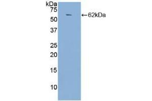 Western blot analysis of recombinant Human ACE. (Angiotensin I Converting Enzyme 1 antibody  (AA 814-1071))