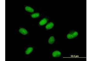 Immunofluorescence of purified MaxPab antibody to GTF2E1 on HepG2 cell. (GTF2E1 antibody  (AA 1-439))