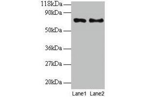 Western blot All lanes: TAX1BP3 antibody at 2 μg/mL Lane 1: EC109 whole cell lysate Lane 2: 293T whole cell lysate Secondary Goat polyclonal to rabbit IgG at 1/15000 dilution Predicted band size: 14 kDa Observed band size: 70 kDa (TAX1BP3 antibody  (AA 1-124))