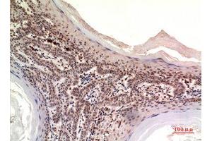 Immunohistochemistry (IHC) analysis of paraffin-embedded Human Skin, antibody was diluted at 1:100. (NOV antibody  (Internal Region))