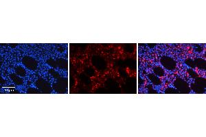 Rabbit Anti-NR4A2 Antibody   Formalin Fixed Paraffin Embedded Tissue: Human Bone Marrow Tissue Observed Staining: Cytoplasm Primary Antibody Concentration: 1:600 Other Working Concentrations: N/A Secondary Antibody: Donkey anti-Rabbit-Cy3 Secondary Antibody Concentration: 1:200 Magnification: 20X Exposure Time: 0. (NR4A2 antibody  (C-Term))