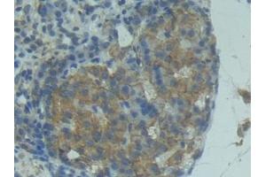 Detection of FASL in Rat Pancreas Tissue using Polyclonal Antibody to Factor Related Apoptosis Ligand (FASL) (FASL antibody  (AA 100-278))