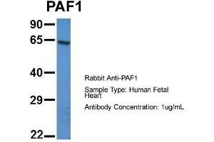 Host: Rabbit  Target Name: PAF1  Sample Tissue: Human Fetal Heart  Antibody Dilution: 1. (PAF1/PD2 antibody  (N-Term))
