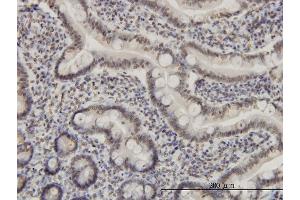 Immunoperoxidase of monoclonal antibody to MEF2A on formalin-fixed paraffin-embedded human small Intestine. (MEF2A antibody  (AA 71-170))
