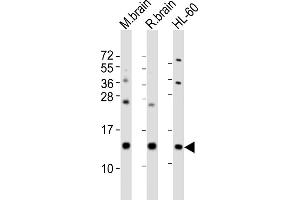 All lanes : Anti-FKBP1A Antibody (Center) at 1:2000 dilution Lane 1: mouse brain lysates Lane 2: rat brain lysates Lane 3: HL-60 whole cell lysates Lysates/proteins at 20 μg per lane. (FKBP1A antibody  (AA 34-68))