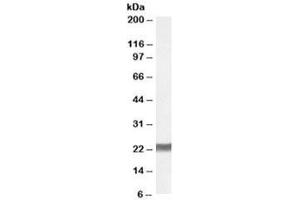 Western blot testing of human placenta lysate with SM22 alpha antibody at 0. (Transgelin antibody)
