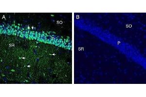 Expression of xCT/SLC7A11 in mouse hippocampus - Immunohistochemical staining of perfusion-fixed frozen mouse brain sections with Anti-xCT/SLC7A11 (extracellular) Antibody (ABIN7043751, ABIN7044835 and ABIN7044836), (1:300), followed by goat anti-rabbit-AlexaFluor-488. (SLC7A11 antibody  (3rd Extracellular Loop))