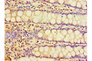 Immunohistochemistry of paraffin-embedded human rectum tissue using CHRFAM7A Antibody at a dilution of 1:100. (CHRFAM7A antibody  (AA 1-150))