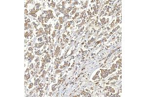 IHC analysis of TXNDC5 using anti-TXNDC5 antibody (ABIN7599699). (TXNDC5 antibody  (AA 109-403))