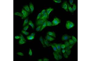 Immunofluorescence staining of HepG2 cells with ABIN7148760 at 1:200, counter-stained with DAPI. (Cullin 7 antibody  (AA 312-450))