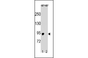 Western blot analysis of SLCO6A1 Antibody (C-term) Pab (ABIN1881814 and ABIN2843228) pre-incubated without(lane 1) and with(lane 2) blocking peptide in  cell line lysate.