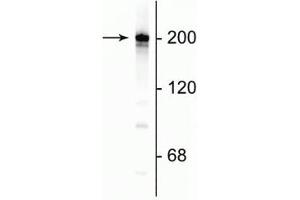 Western blot of rat cortical lysate showing specific immunolabeling of the ~200 kDa NF-H protein. (NEFH antibody)