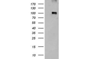 HEK293T cells were transfected with the empty vector control (Left lane) or Human LGR5 expression plasmid (Right lane) cDNA for 48 hrs and lysed. (LGR5 antibody  (AA 250-550))
