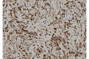 ABIN6278875 at 1/100 staining Human gastric tissue by IHC-P. (IFI44 antibody  (Internal Region))