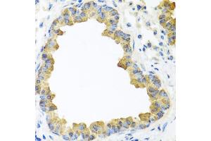 Immunohistochemistry of paraffin-embedded mouse lung using WNT5B antibody (ABIN5974661) at dilution of 1/100 (40x lens). (WNT5B antibody)