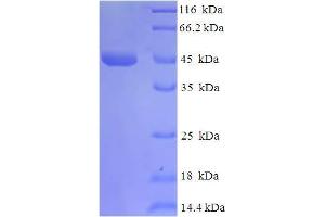 SDS-PAGE (SDS) image for BLAT (AA 24-286) protein (His-SUMO Tag) (ABIN5710970) (BLAT (AA 24-286) protein (His-SUMO Tag))