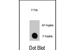 Dot blot analysis of anti-TSC2-p Phospho-specific Pab (R) on nitrocellulose membrane. (Tuberin antibody  (pThr1462))