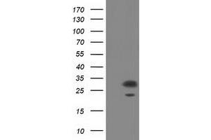 HEK293T cells were transfected with the pCMV6-ENTRY control (Left lane) or pCMV6-ENTRY PYCR2 (Right lane) cDNA for 48 hrs and lysed. (PYCR2 antibody)