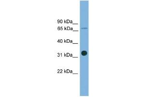 WB Suggested Anti-SLC5A4 Antibody Titration: 0. (SLC5A4 antibody  (Middle Region))
