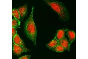 IF analysis of UTX/KDM6A using anti-UTX/KDM6A antibody (ABIN7601589).