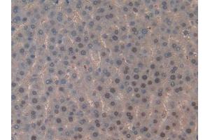 DAB staining on IHC-P; Samples: Rat Liver Tissue (TOP2 antibody  (AA 1079-1328))