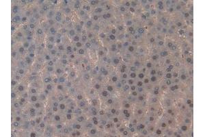 DAB staining on IHC-P; Samples: Rat Liver Tissue (TOP2 antibody  (AA 1079-1328))