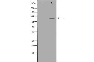 Western blot analysis of A549  using RRM1 antibody. (RRM1 antibody  (Internal Region))