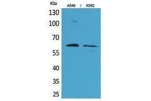 Western Blotting (WB) image for anti-SMAD, Mothers Against DPP Homolog 1 (SMAD1) (Ser794) antibody (ABIN3180401) (SMAD1 antibody  (Ser794))
