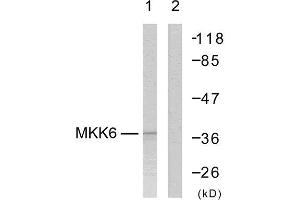 Western Blotting (WB) image for anti-Mitogen-Activated Protein Kinase Kinase 3 (MAP2K3) (Ser207) antibody (ABIN1848130) (MAP2K3 antibody  (Ser207))