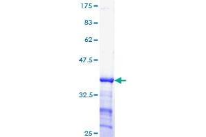 Image no. 1 for Cyclin E1 (CCNE1) (AA 311-410) protein (GST tag) (ABIN1348461) (Cyclin E1 Protein (CCNE1) (AA 311-410) (GST tag))