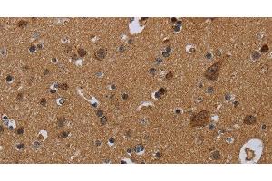 Immunohistochemistry of paraffin-embedded Human brain using NDUFS8 Polyclonal Antibody at dilution of 1:50 (NDUFS8 antibody)