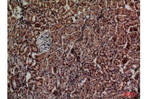 Immunohistochemistry (IHC) image for anti-Adrenomedullin (ADM) (Internal Region) antibody (ABIN3187738)