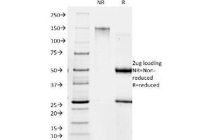 SDS-PAGE Analysis Purified RANK Giardia lamblia Mouse Monoclonal Antibody (BB1. (Giardia Lamblia antibody)