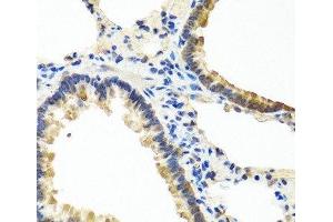 Immunohistochemistry of paraffin-embedded Rat lung using ANGPT1 Polyclonal Antibody at dilution of 1:100 (40x lens). (Angiopoietin 1 antibody)