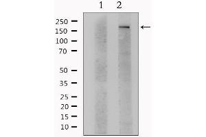 Western blot analysis of extracts from Hela, using ITGAM Antibody. (CD11b antibody  (Internal Region))