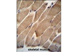 ELMO2 Antibody (Center) (ABIN655058 and ABIN2844687) immunohistochemistry analysis in formalin fixed and paraffin embedded human skeletal muscle followed by peroxidase conjugation of the secondary antibody and DAB staining. (ELMO2 antibody  (AA 323-350))