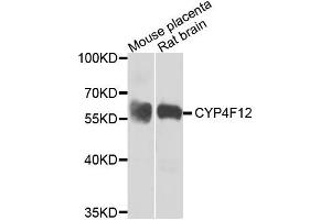 Western blot analysis of extracts of mouse placenta and rat brain, using CYP4F12 antibody.